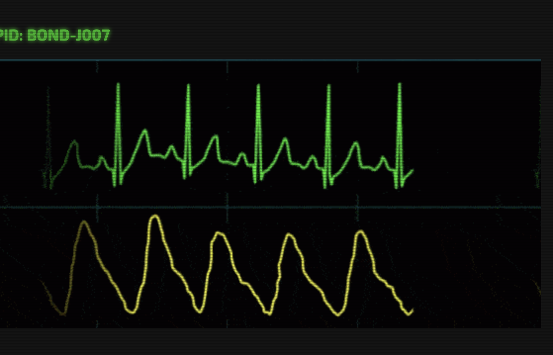 UI Code Challenge #1 – Heartbeats